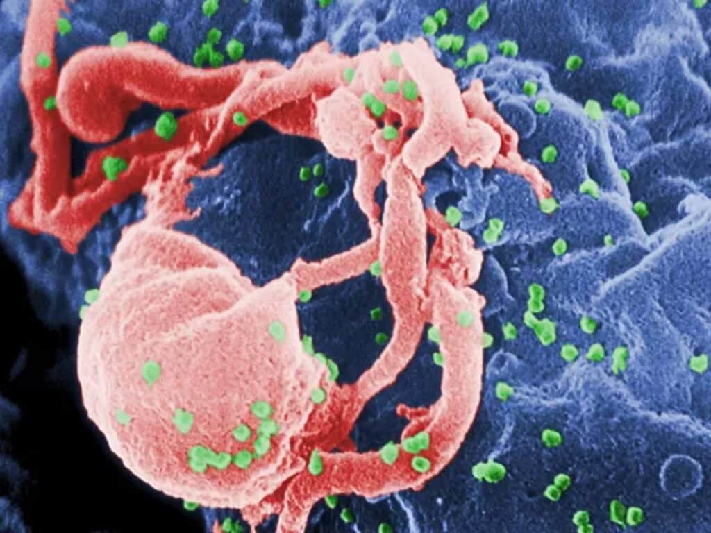 بدن دومین بیمار مبتلا به ایدز از ویروس «اچ آی وی» پاکسازی شد