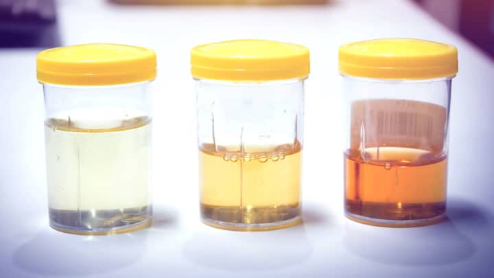 colour of urine