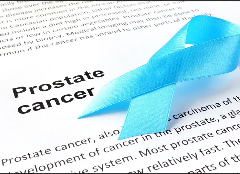 برای کاهش خطر ابتلا به سرطان پروستات چه باید کرد؟