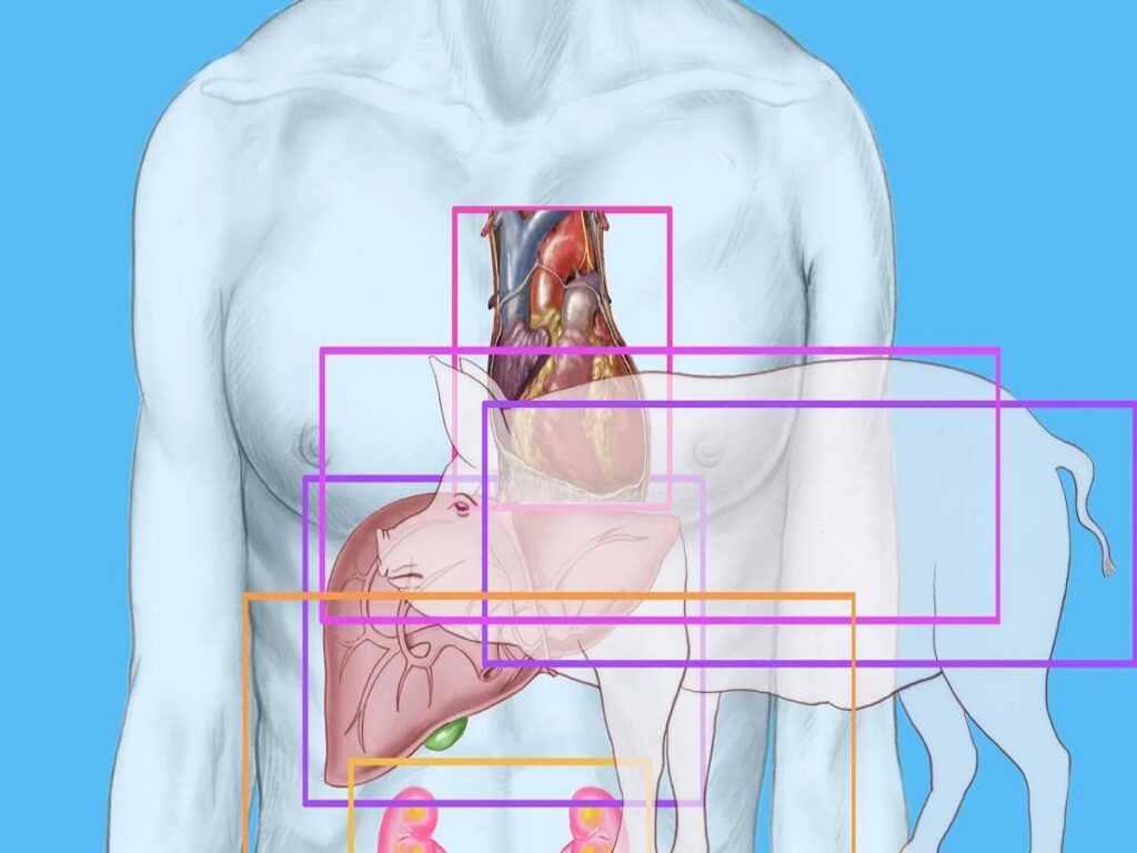 پیوند موفق ریه خوک به بدن انسان؛ ثبت یک رکورد جهانی
