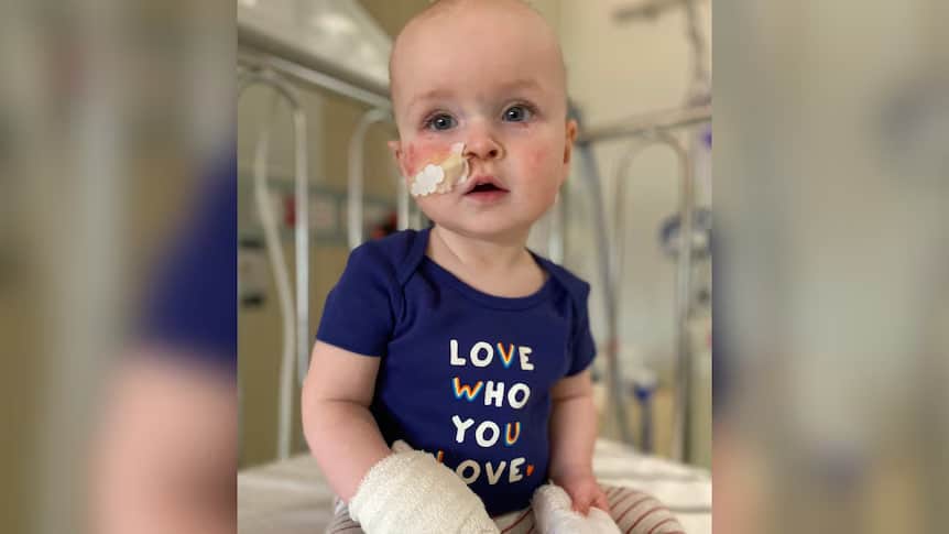 افزایش ابتلای نوزادان به ویروس سین‌ سیشیال تنفسی