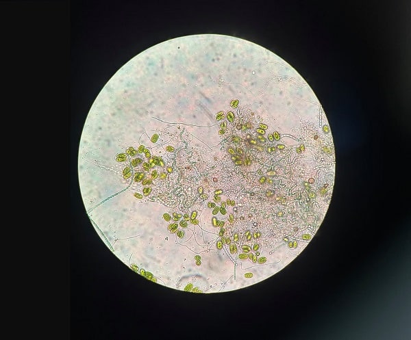 تابآوری اکوسیستم در برابر تخریب انسانی