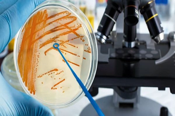 چرا عفونت‌های کشنده و تهاجمی در کانادا در حال افزایش است