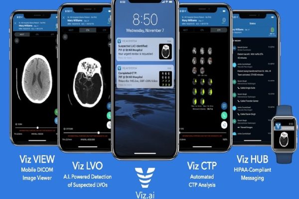 ابزار تشخیص سکته مغزی با موبایل، سکته را در کسری از ثانیه تشخیص می‌دهد