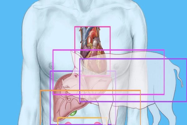پیوند موفق ریه خوک به بدن انسان؛ ثبت یک رکورد جهانی پیوند موفق ریه خوک به بدن انسان؛ ثبت یک رکورد جهانی