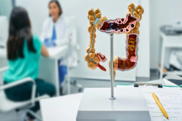 مصرف منظم آسپرین با کاهش سرطان کولورکتال ارتباط دارد