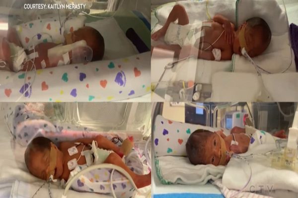 تولد خوشیمن چهارقلوهای ساسکاچوانی در روز کبیسه کانادا تولد خوشیمن چهارقلوهای ساسکاچوانی در روز کبیسه کانادا