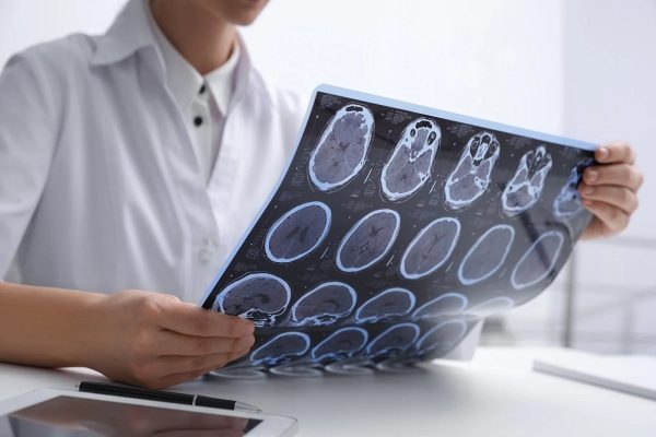 با این تغییر رژیم غذایی، خطر ابتلا به زوال عقل ۲۰ درصد کاهش می‌یابد