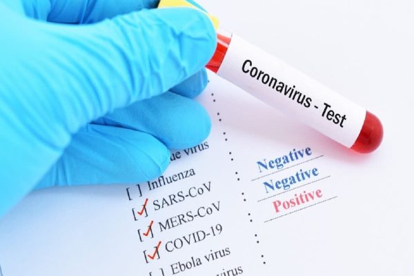 کیت کروناویروس