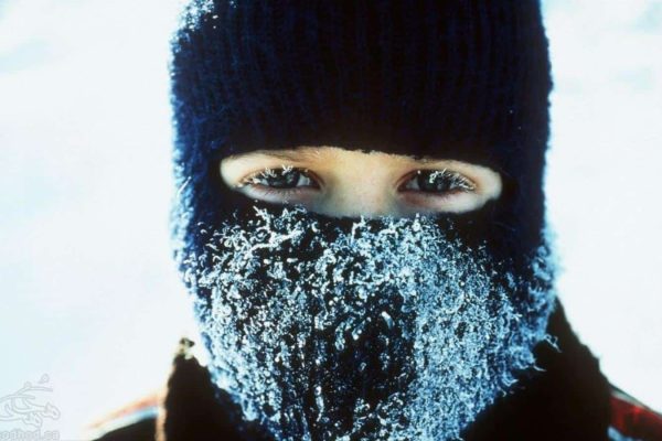 Frostbite سرمازدگی