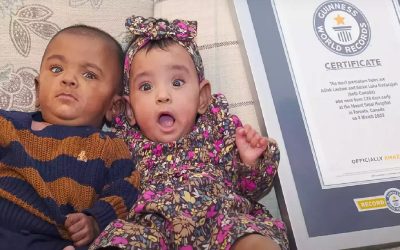 دوقلوهای نارس کانادایی اولین تولدشان را با ثبت رکورد جهانی جشن می‌گیرند