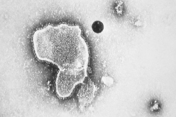 ایالات متحده پر از بیماران مبتلا به سنسیشیال تنفسی شده، آیا کانادا هم به همین وضع دچار خواهد شد؟