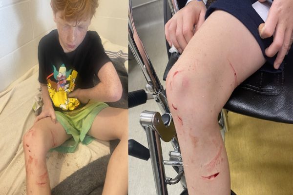 پسربچه هشت ساله در جدال با هيولای آب پسربچه هشت ساله در جدال با هيولای آب